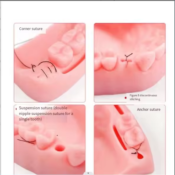 Dental Module Suture Training Kit Simulated Oral Suture Model for Medical Training Tooth and Gingival Suture Practice Pad